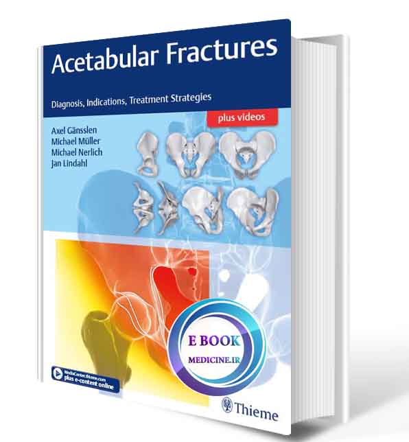 دانلود کتابAcetabular Fractures: Diagnosis, Indications, Treatment Strategies 1st 2018 (ORIGINAL PDF)